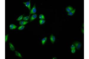 Immunofluorescence staining of Hela cells with ABIN7168823 at 1:33, counter-stained with DAPI. (SEMA6B 抗体  (AA 756-888))