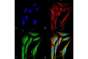 Immunocytochemistry/Immunofluorescence analysis using Mouse Anti-MMP9 Monoclonal Antibody, Clone S51-82 . (MMP 9 抗体  (AA 1-708) (Atto 594))