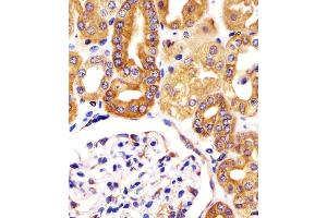 (ABIN6244121 and ABIN6578389) staining VAC14 in human kidney tissue sections by Immunohistochemistry (IHC-P - paraformaldehyde-fixed, paraffin-embedded sections). (VAC14 抗体  (AA 125-159))