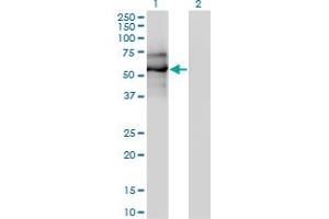 Western Blot analysis of EBF1 expression in transfected 293T cell line by EBF1 monoclonal antibody (M01A), clone 1C12. (EBF1 抗体  (AA 1-591))