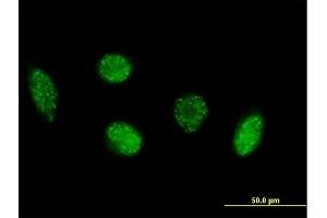Immunofluorescence of purified MaxPab antibody to VIM on HeLa cell. (Vimentin 抗体  (AA 1-466))
