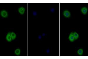 Detection of IL4R in Human Hela cell using Polyclonal Antibody to Interleukin 4 Receptor (IL4R) (IL4 Receptor 抗体  (AA 26-232))