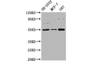 Western Blot Positive WB detected in: SH-SY5Y whole cell lysate, MCF-7 whole cell lysate, U87 whole cell lysate All lanes: IGHM antibody at 3. (IGHM 抗体  (AA 45-178))