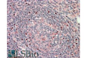 Immunohistochemistry (IHC) image for anti-CTD (Carboxy-terminal Domain, RNA Polymerase II, Polypeptide A) Small Phosphatase 1 (CTDSP1) (Internal Region) antibody (ABIN940552)