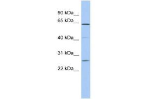 WB Suggested Anti-FAM71B Antibody Titration: 0. (FAM71B 抗体  (Middle Region))