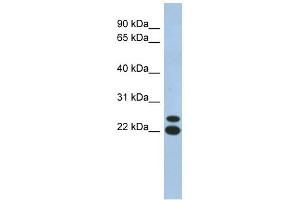 C19ORF54 antibody used at 1 ug/ml to detect target protein. (C19orf54 抗体  (N-Term))