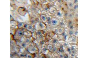 Used in DAB staining on fromalin fixed paraffin-embedded liver tissue (CD101 抗体  (AA 566-784))