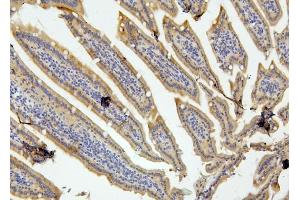 IHC analysis of RET using anti-RET antibody (ABIN6719502). (Ret Proto-Oncogene 抗体  (AA 29-304))