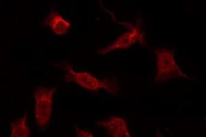 ABIN6266665 staining COS7 by IF/ICC. (TRADD 抗体)