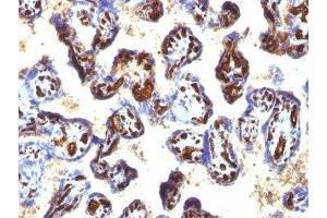 Formalin-fixed, paraffin-embedded human placenta stained with CD34 antibody (QBEnd/10 + HPCA1/763)