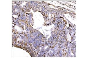 IHC analysis of NDEL1 using anti-NDEL1 antibody (ABIN7602511). (NDEL1 抗体  (AA 80-320))