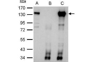 IP Image CIZ1 antibody immunoprecipitates CIZ1 protein in IP experiments. (CIZ1 抗体)