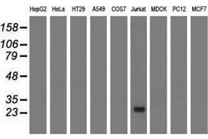 Western blot analysis of extracts (35 µg) from 9 different cell lines by using anti-RIT2 monoclonal antibody. (RIT2 抗体)