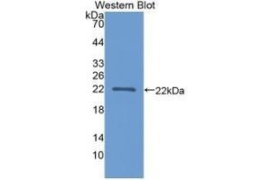 Detection of recombinant APOA1BP using Polyclonal Antibody to Apolipoprotein A1 Binding Protein (APOA1BP) (APOA1BP 抗体  (AA 118-282))