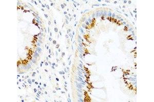 Immunohistochemistry of paraffin-embedded Human colon using FAM3B Polyclonal Antibody at dilution of 1:100 (40x lens). (FAM3B 抗体)