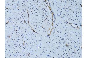 Immunohistochemistry of paraffin-embedded human uterus using SELE Antibody (ABIN5971217) at dilution of 1/100 (40x lens). (Selectin E/CD62e 抗体)