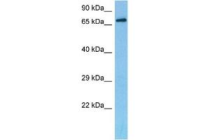Host:  Mouse  Target Name:  DACH2  Sample Tissue:  Mouse Liver  Antibody Dilution:  1ug/ml (DACH2 抗体  (C-Term))