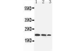 Anti-IL-10 antibody, Western blotting Lane 1: Recombinant Human IL-10 Protein 10ng Lane 2: Recombinant Human IL-10 Protein 5ng Lane 3: Recombinant Human IL-10 Protein 2. (IL-10 抗体  (N-Term))