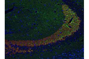Indirect immunostaining of PFA fixed paraffin embedded mouse hippocampus section with anti-Synaptoporin (dilution 1 : 500; red) and chicken anti-Tau (, dilution 1 : 500; green).