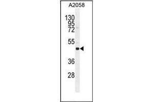 Western blot analysis in A2058 cell line lysates using SOCS4 Antibody  (35ug/lane). (SOCS4 抗体  (AA 234-262))