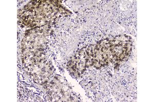 IHC analysis of CRM1 using anti-CRM1 antibody . (XPO1 抗体  (AA 966-1071))