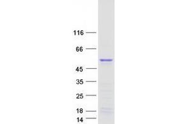 TWIST Neighbor Protein (TWISTNB) (Myc-DYKDDDDK Tag)