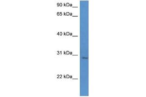 WB Suggested Anti-UTP23 Antibody Titration: 0. (UTP23 抗体  (C-Term))