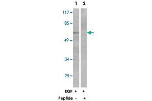Western blot analysis of extracts from 293 cells, treated with EGF (200 ng/mL, 30 mins), using OPRM1 polyclonal antibody . (Mu Opioid Receptor 1 抗体)