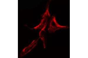 ABIN6275115 staining HuvEc cells by IF/ICC. (KDELR2 抗体  (Internal Region))