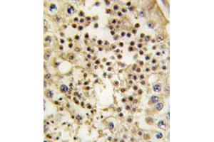 Immunohistochemical staining of formalin-fixed and paraffin-embedded human testis tissue reacted with LIN28 monoclonal antibody  at 1:50-1:200 dilution. (LIN28A 抗体)