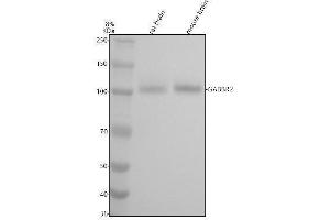 Western blot analysis of GABA B Receptor 2 using anti-GABA B Receptor 2 antibody (ABIN7604913).
