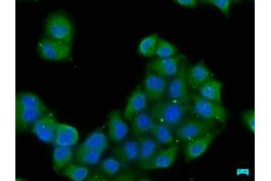 Immunofluorescence staining of Hela cells with ABIN7152261 at 1:50, counter-stained with DAPI. (EXOC8 抗体  (AA 508-725))