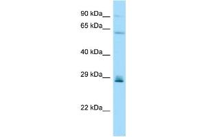 WB Suggested Anti-CD99L2 Antibody Titration: 1. (CD99L2 抗体  (Middle Region))