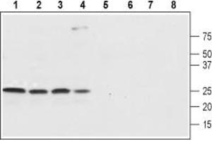 anti-Sodium Channel, Voltage-Gated, Type IV, beta Subunit (SCN4B) (AA 85-98), (Extracellular) antibody