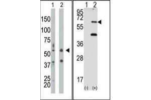 Image no. 1 for anti-Eukaryotic Translation Initiation Factor 2-alpha Kinase 2 (EIF2AK2) (N-Term) antibody (ABIN360663)