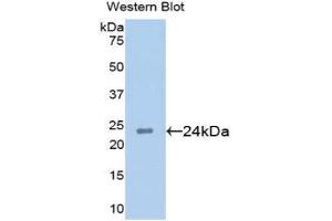 Western Blotting (WB) image for anti-Anterior Gradient Homolog 2 (Xenopus Laevis) (AGR2) (AA 21-175) antibody (ABIN1077803) (AGR2 抗体  (AA 21-175))