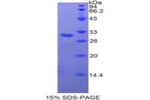 SDS-PAGE analysis of Human Neurofascin Protein. (NFASC 蛋白)