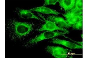Immunofluorescence (IF) image for anti-Protein Kinase, CAMP-Dependent, Regulatory, Type II, alpha (PRKAR2A) (AA 1-105) antibody (ABIN562376)