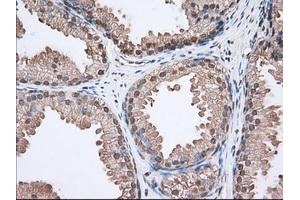Immunohistochemical staining of paraffin-embedded Human lung tissue using anti-ACAT2 mouse monoclonal antibody. (ACAT2 抗体)