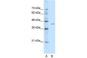 ZBTB26 antibody used at 0. (ZBTB26 抗体  (Middle Region))