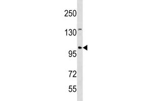 Western Blotting (WB) image for anti-Establishment of Cohesion 1 Homolog 1 (ESCO1) antibody (ABIN3004513) (ESCO1 抗体)