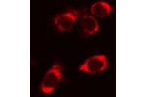 ABIN6266984 staining Hela cells by IF/ICC. (STARD13 抗体  (N-Term))