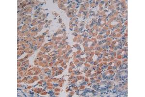 Used in DAB staining on fromalin fixed paraffin- embedded stomach tissue (EIF2AK2 抗体  (AA 205-495))