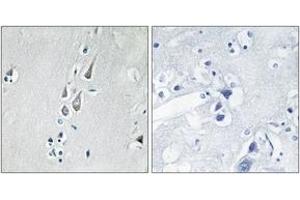 Immunohistochemistry analysis of paraffin-embedded human brain, using CaMK2 (Phospho-Thr286) Antibody. (CAMK2B 抗体  (pThr286))