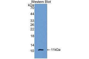 Western blot analysis of the recombinant protein. (beta-Thromboglobulin 抗体  (AA 40-113))