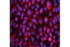 IF analysis of FACL4/ACSL4 using anti-FACL4/ACSL4 antibody (ABIN7602756).