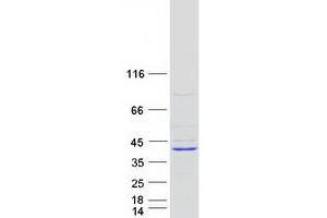 Western Blotting (WB) image for Lipid Droplet-Associated Hydrolase (LDAH) protein (Myc-DYKDDDDK Tag) (ABIN2715498)