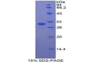 SDS-PAGE analysis of Human STAM Binding Protein. (STAMBP 蛋白)