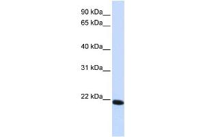 WB Suggested Anti-CLDN19 Antibody Titration:  0. (Claudin 19 抗体  (C-Term))