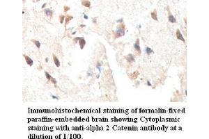Image no. 1 for anti-Catenin (Cadherin-Associated Protein), alpha 2 (CTNNA2) antibody (ABIN791201) (CTNNA2 抗体)